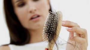 biosttera es la mejor marca para tratar la caida del cabello